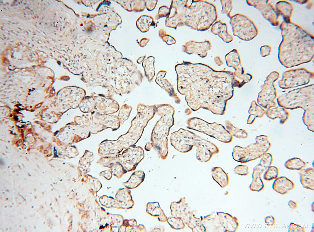 INPP5E Antibody IHC human placenta tissue 17797-1-AP