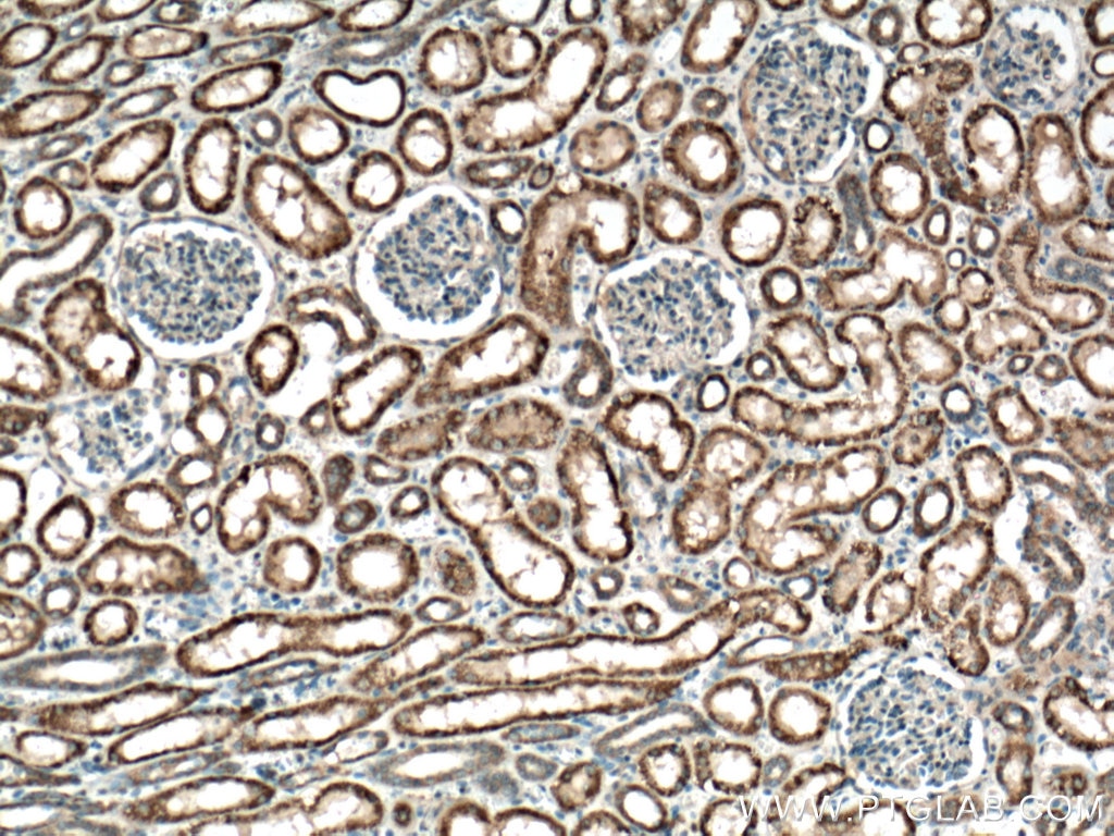 JAK2 Antibody IHC human kidney tissue 17670-1-AP
