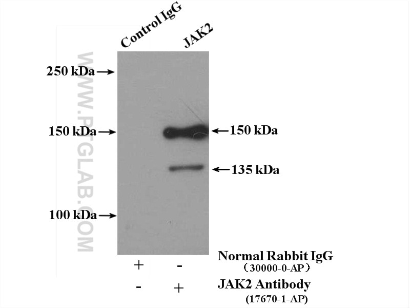 JAK2 Antibody IP Jurkat cells 17670-1-AP