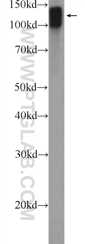 Antibody Stability At Room Temperature Antibody Stability At Room Temperature