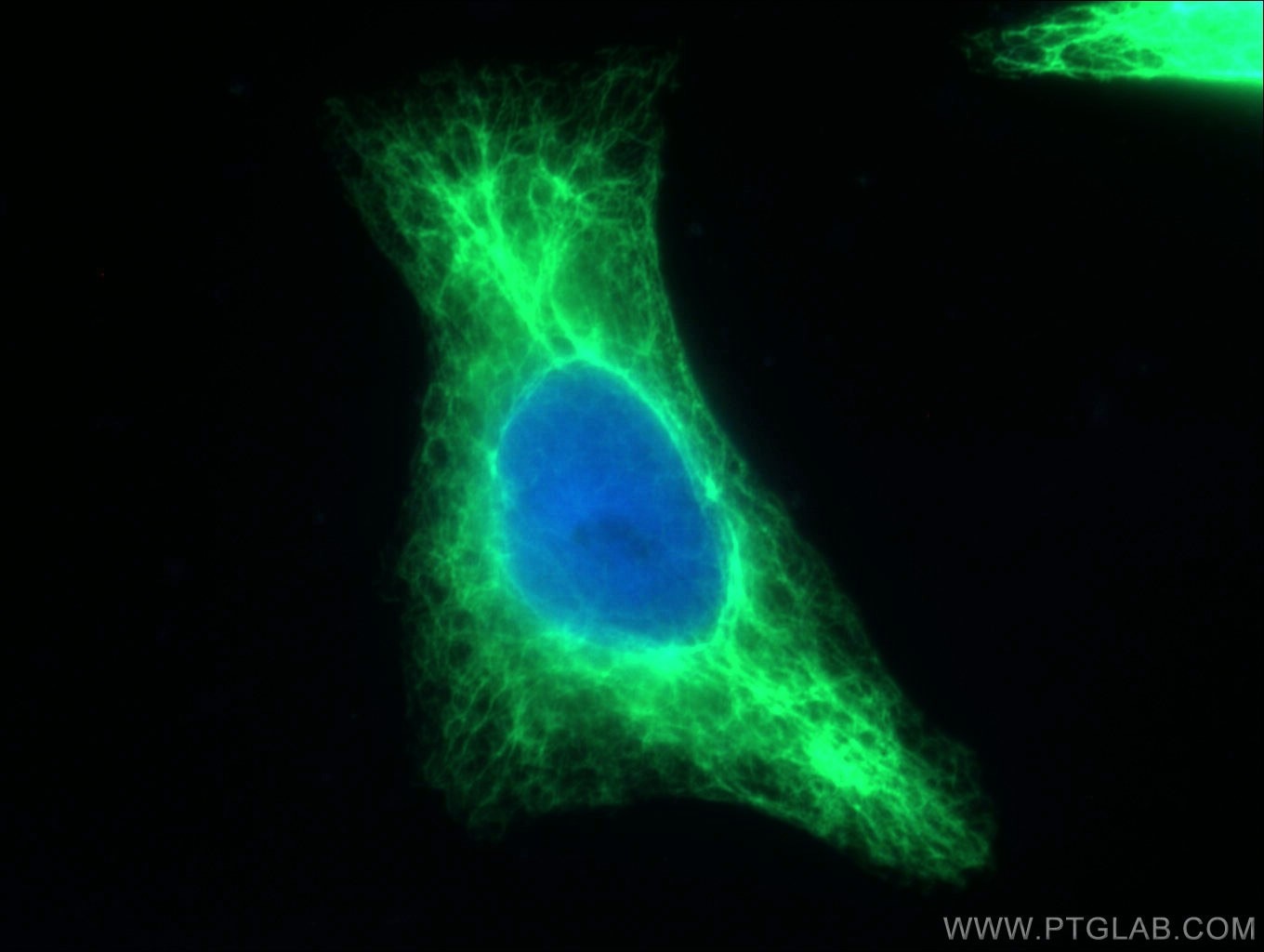 Cytokeratin 17-Specific Antibody 17516-1-AP | Proteintech
