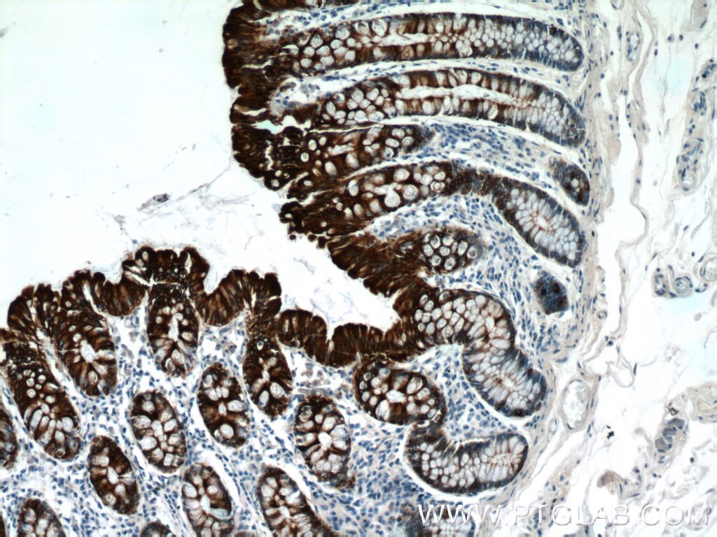 CEA antibody (10421-1-AP) | Proteintech