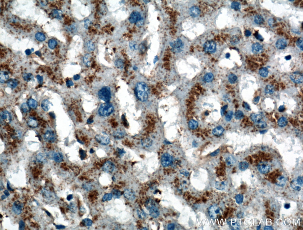 LIMPII抗体を使用したパラフィン包埋ヒト肝組織スライドの免疫組織化学染色