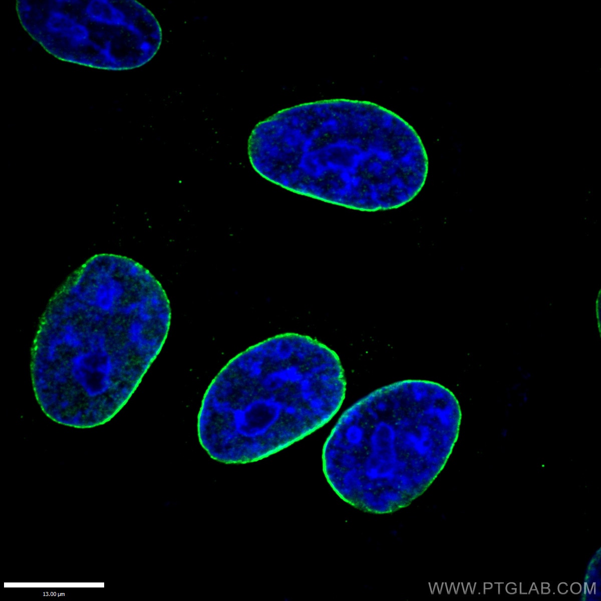 Lamin B1 Antibody IF HepG2 cells 12987-1-AP