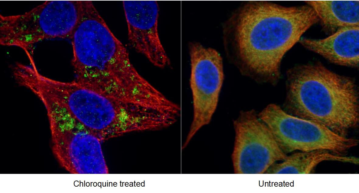 LC3B-Specific Antibody staining (18725-1-AP; 1:50; green) in untreated (Left) and Chloroquine treated (Right) HepG2 cells. The cells were co-stained with tubulin (66031-1-Ig; 1:100; red), under 40 x