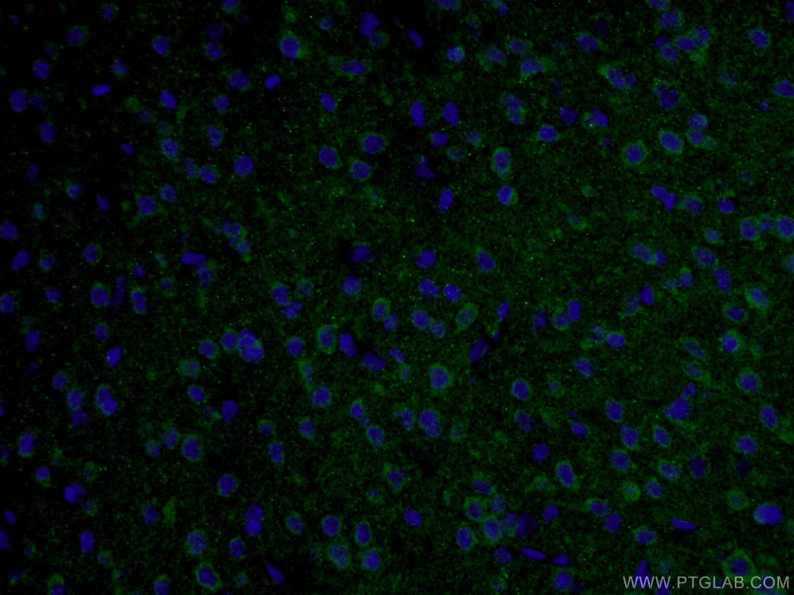 TAU Antibody IF mouse brain tissue 10274-1-AP