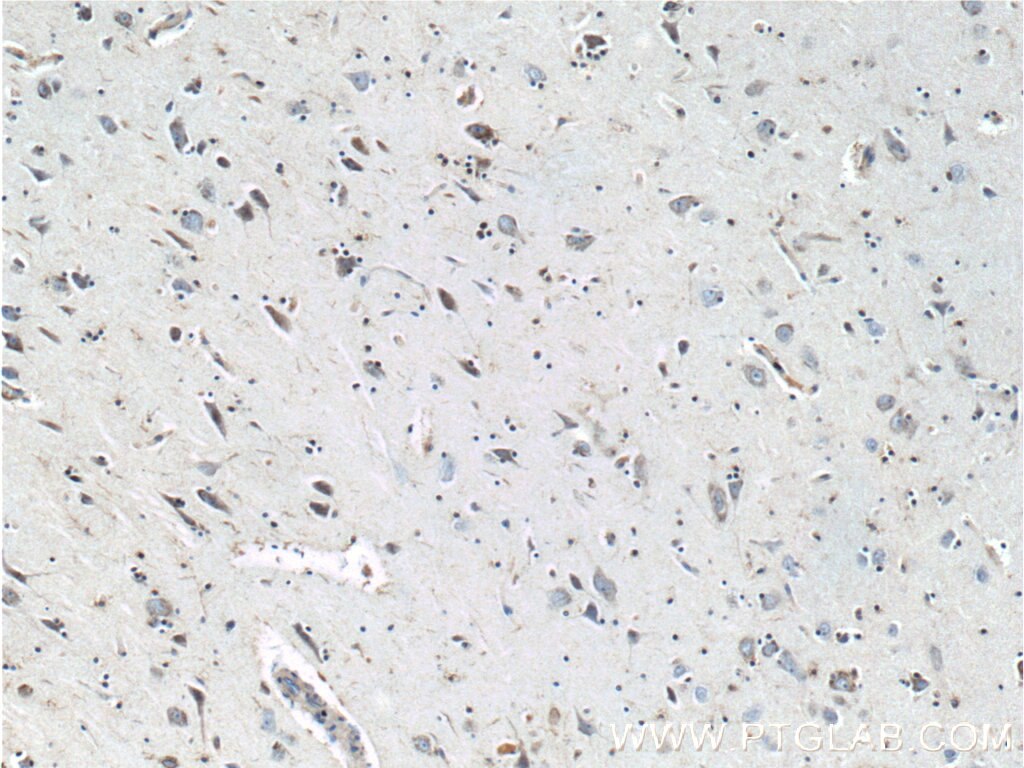 TAU Antibody IHC human brain tissue 10274-1-AP