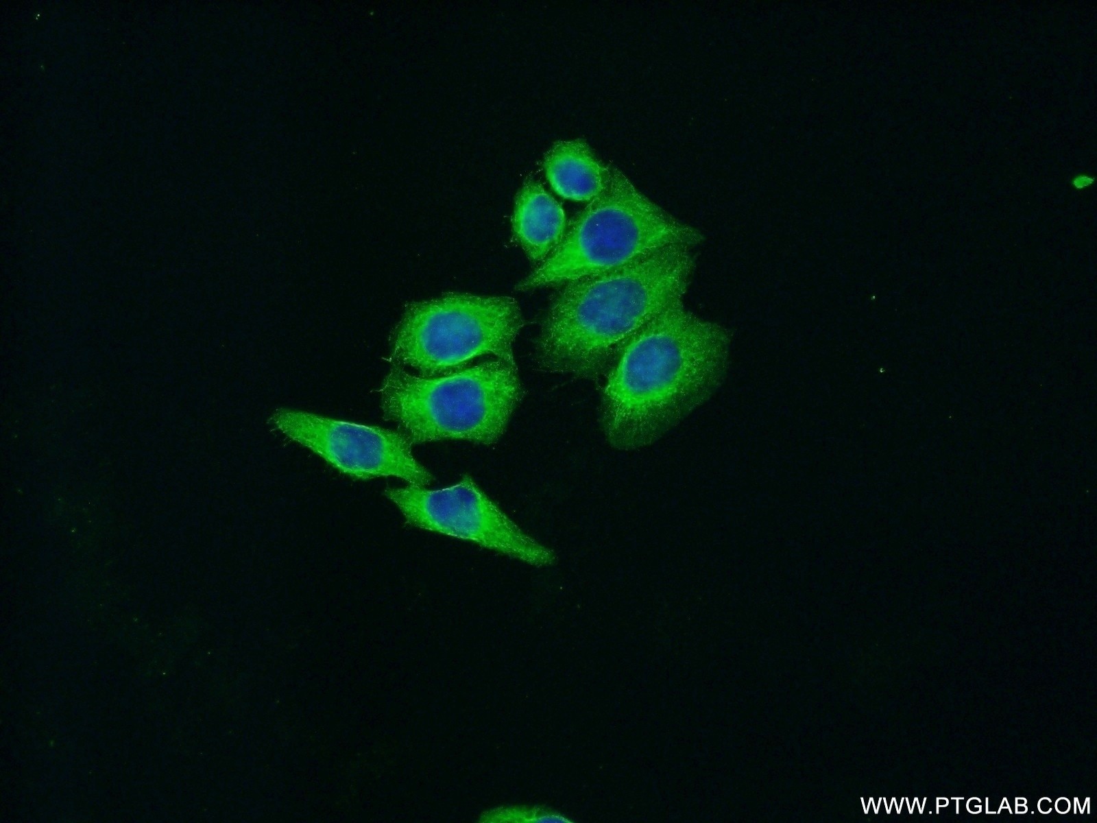 IF analysis of HeLa cells labeling mTOR with 20657-1-AP Proteintech antibody at a dilution of 1:50 and Alexa Fluor 488-conjugated AffiniPure Goat Anti-Rabbit IgG(H+L)
