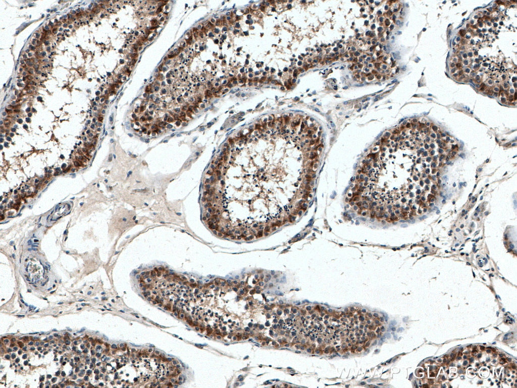 Immunohistochemical analysis of paraffin-embedded human testis tissue slide using 20657-1-AP (mTOR antibody) at dilution of 1:200 (under 10x lens) heat mediated antigen retrieved with Tris-EDTA buffer(pH9)