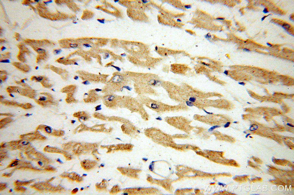 IHC results of paraffin-embedded human heart tissue using MYL7 antibody (17283-1-AP; 1:100, 40x)