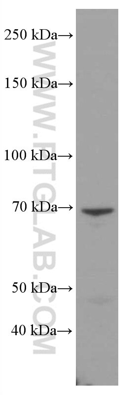 Nd5 Antibody 1 Ig Proteintech