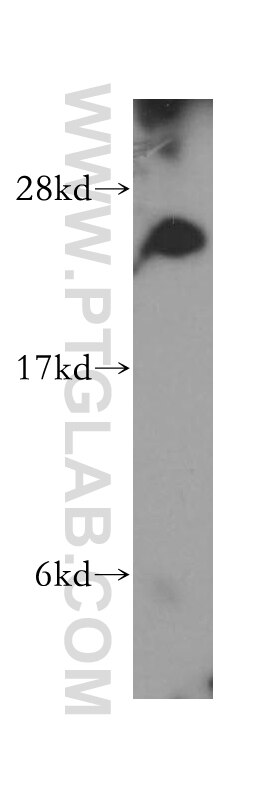 Antibody Stability At Room Temperature Antibody Stability At Room Temperature