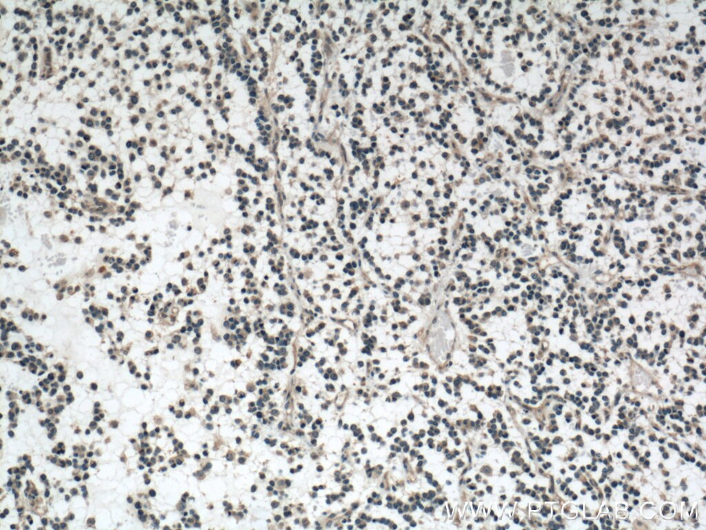 Olig2 Antibody 66513 1 Ig Proteintech