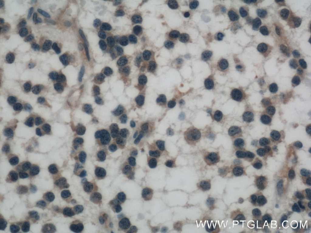 Olig2 Antibody 66513 1 Ig Proteintech