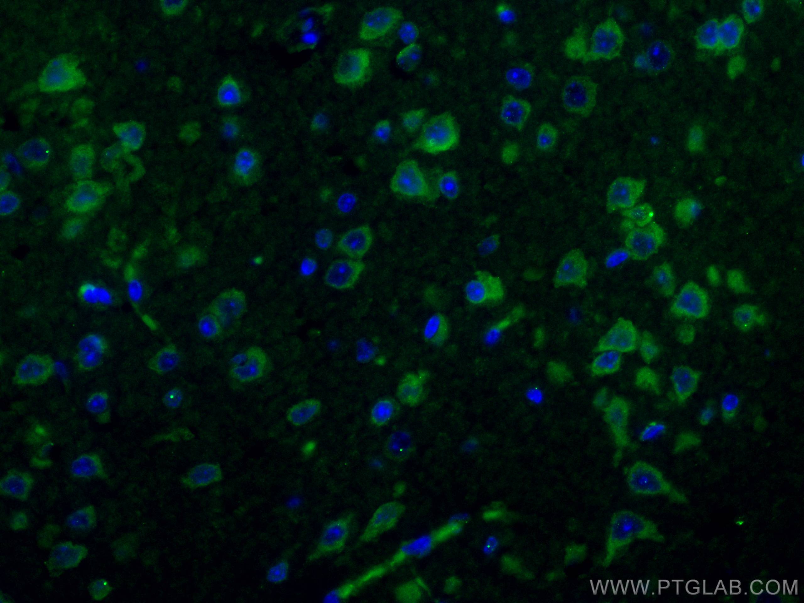 P62,SQSTM1 Antibody IF mouse brain tissue 66184-1-Ig