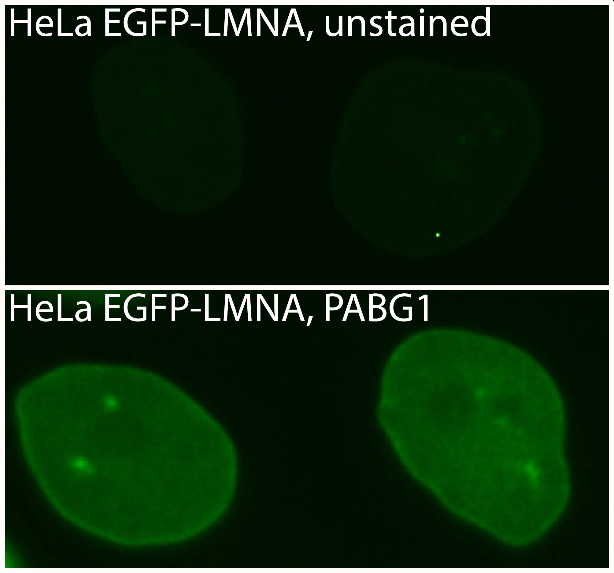 Immunofluorescence Primary antibody: Anti-GFP PABG1 1:1,000 Secondary antibody: anti-rabbit_Alexa488 1:500