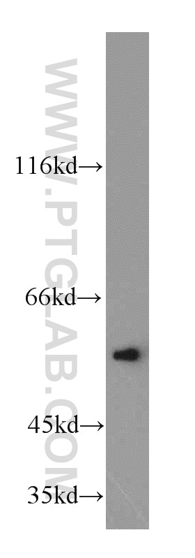 PAX8 Antibody WB HEK-293 cells 10336-1-AP