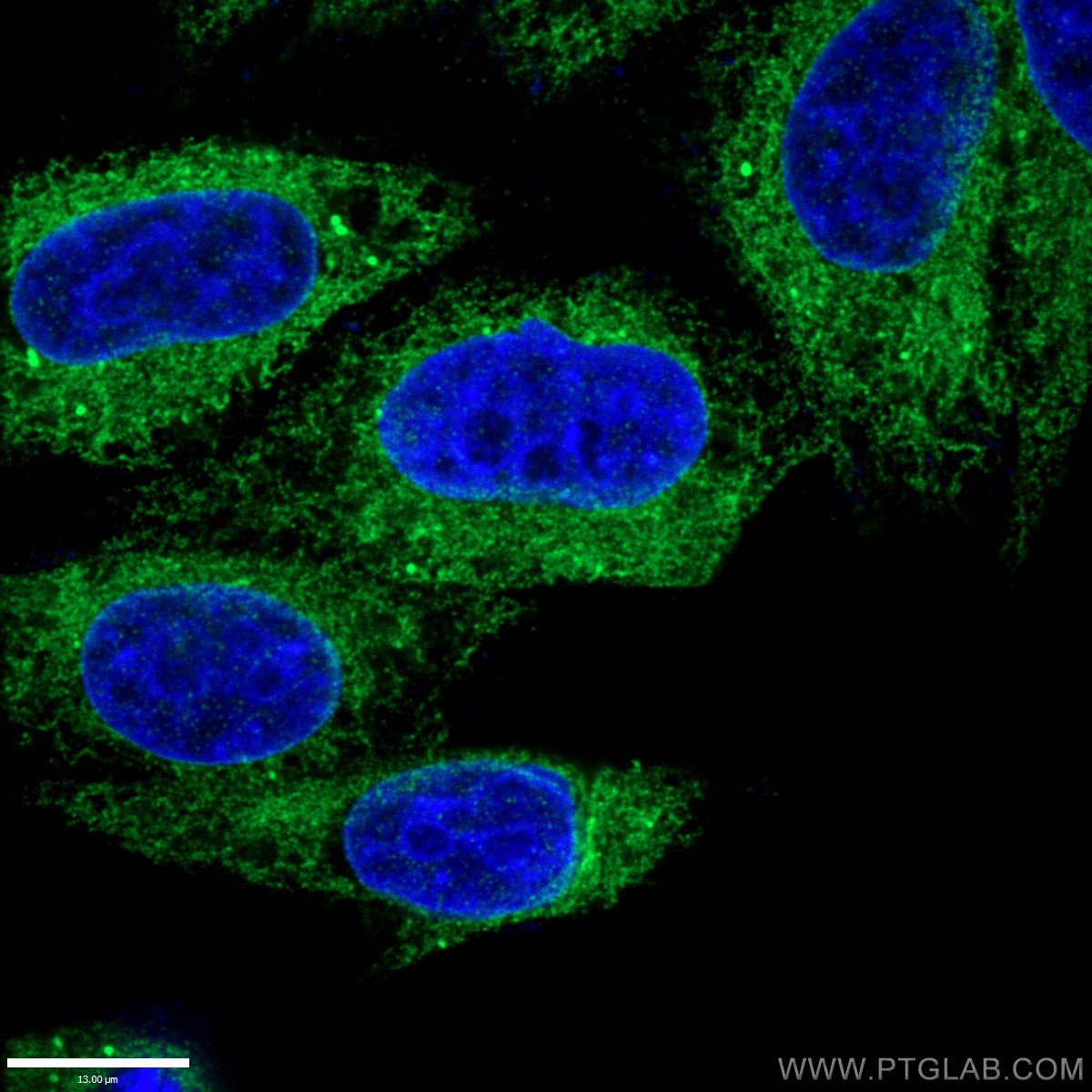 IF staining of fixed HepG2 cells (10% Formaldehyde) using ERp57/ERp60 antibody (15967-1 AP) at a dilution of 1:50 and goat anti-rabbit IgG(H+L) Alexa Fluor 488-conjugated secondary antibody