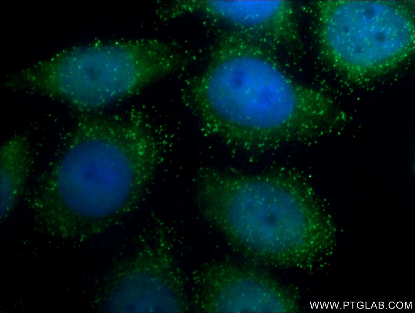 hela cells essay 2018-6-7 henrietta lacks is quite a rare and popular topic for writing an essay, henrietta-lacks-hela-cells-and-cell-culture henrietta lacks’ cells have been. hela cells essay 2018-6-7 henrietta lacks is quite a rare and popular topic for writing an essay, henrietta-lacks-hela-cells-and-cell-culture henrietta lacks’ cells have been.