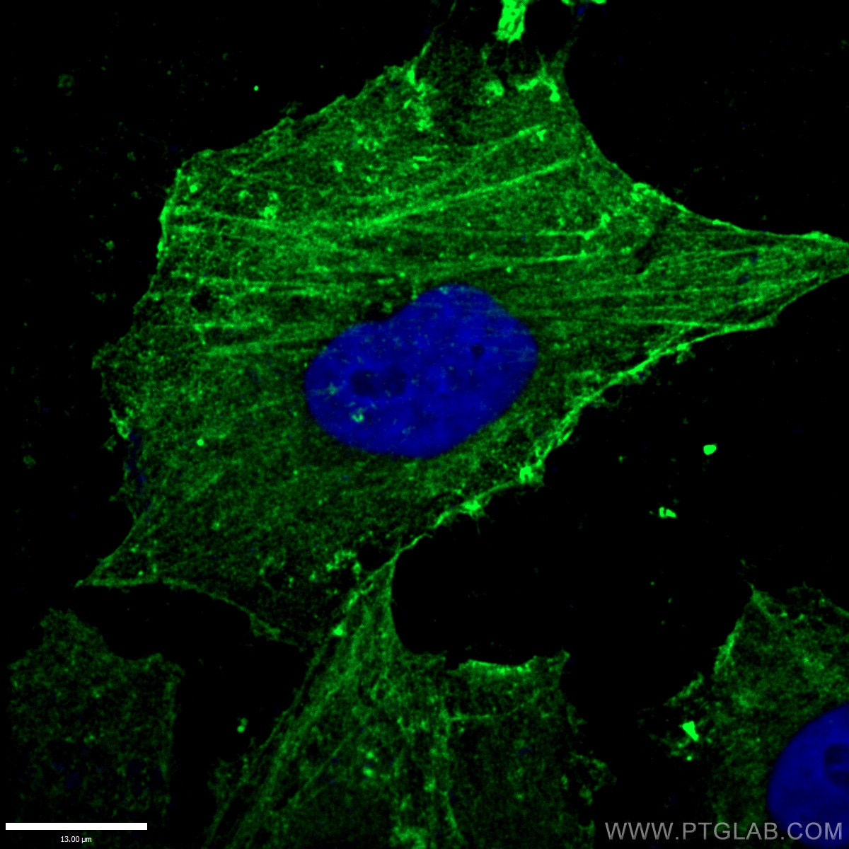 IF analysis of ( -20℃ Ethanol ) fixed HepG2 cells using 66009-1-Ig(beta Actin antibody) at dilution of 1:200 and Alexa Fluor 488-conjugated AffiniPure Goat Anti-Mouse IgG(H+L)