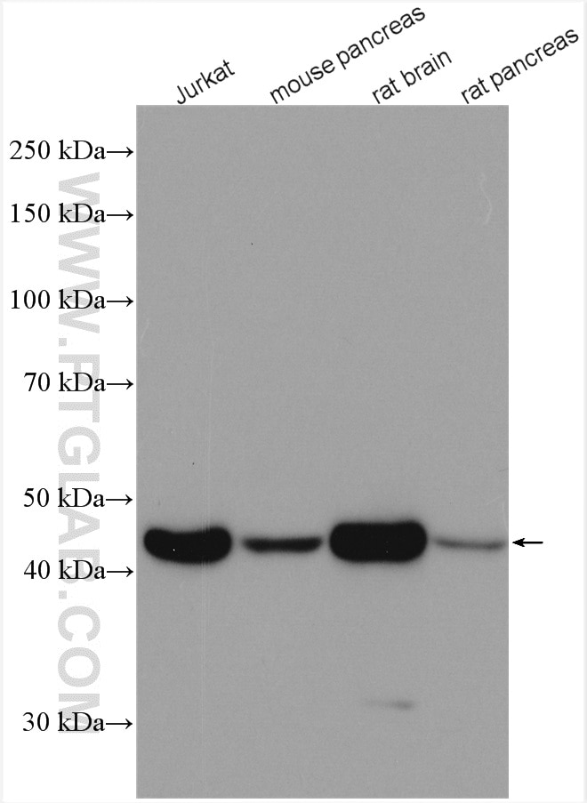 WB analysis of Jurkat cells using using beta actin antibody (66009-1-Ig)