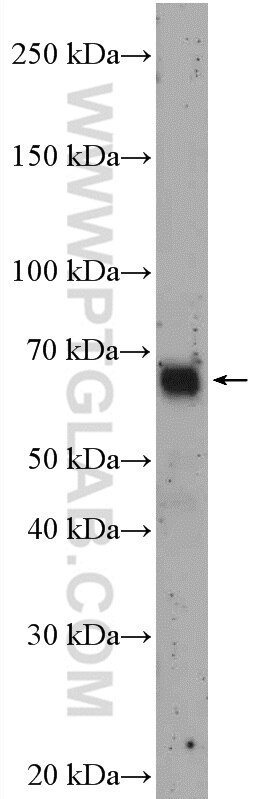 27686 >> Rcor1 Antibody 27686 1 Ap Proteintech 27686 >> Rcor1 Antibody 27686 1 Ap Proteintech