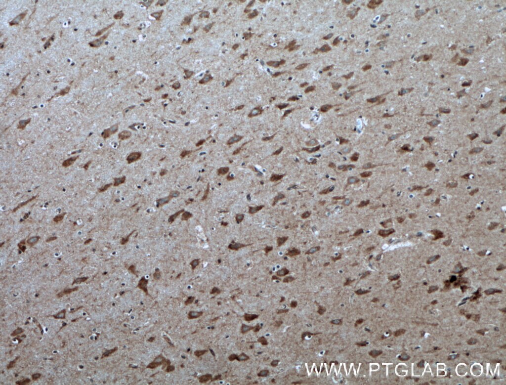 RHEB antibody (159241AP) Proteintech