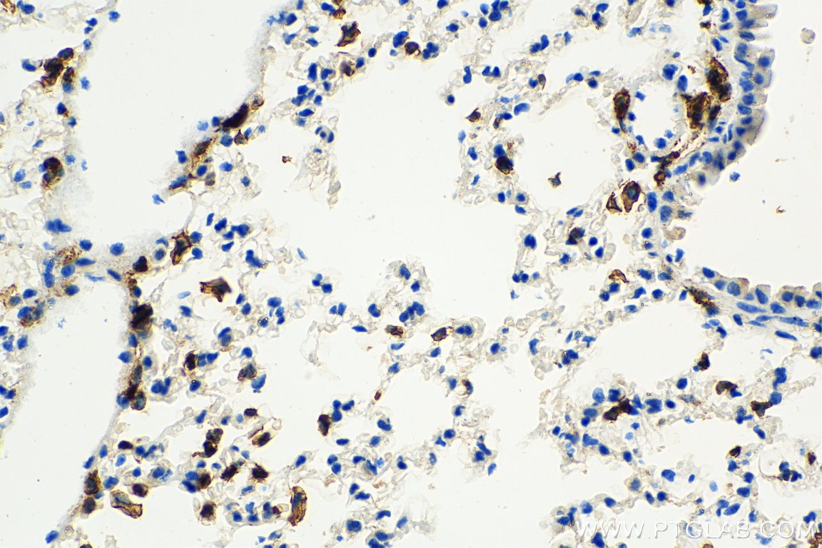 CD45 antibody (20103-1-AP) | Proteintech