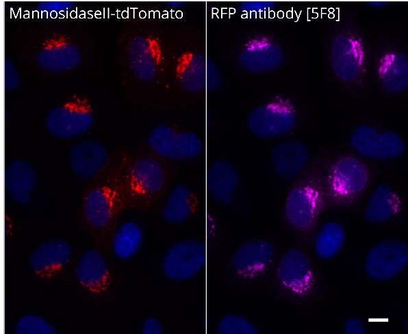 HeLa cells transiently transfected with
MannosidaseII-tdTomato (Golgi).
Primary antibody: [5F8] 1:1,000
Secondary antibody: goat anti-rat Alexa Fluor® 647
Fixation: 3.7 % PFA 
Scale bar: 10 µm
