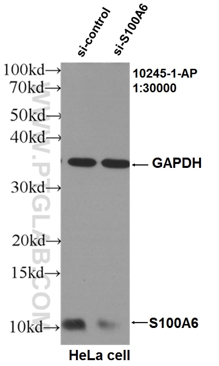 S100A6 Antibody WB HeLa cells 10245-1-AP
