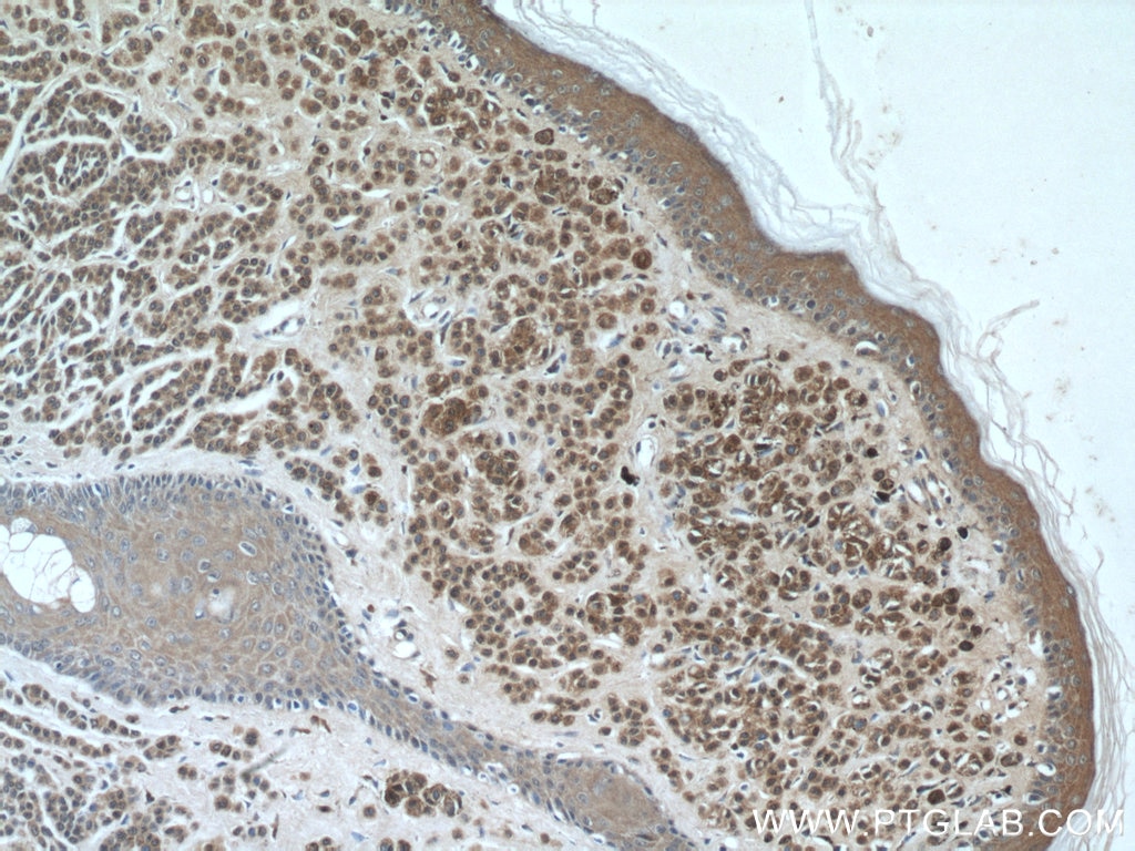 S100 Beta Antibody 1 Ig Proteintech S100 Beta Antibody 1 Ig Proteintech
