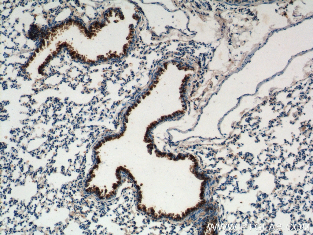 IHC staining of mouse lung tissue using 10490-1-AP