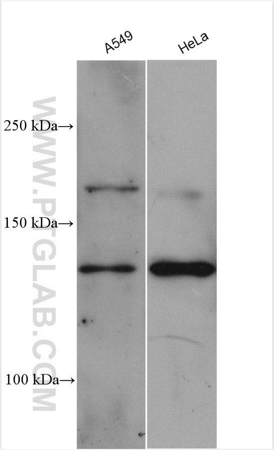 CD138/Syndecan-1 Antibody WB A549 cells 10593-1-AP