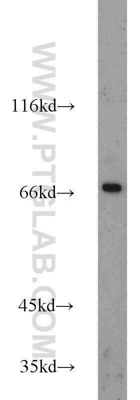 CD138/Syndecan-1 Antibody WB Raji cells 10593-1-AP