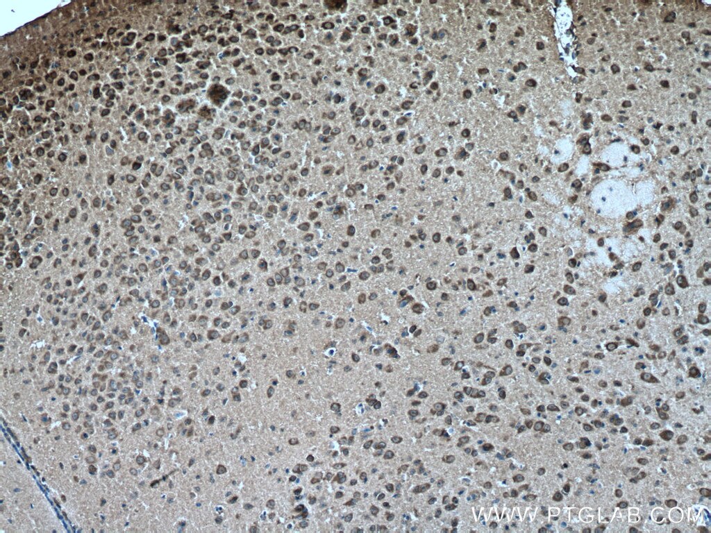 VGLUT1 Antibody IHC mouse brain tissue 55491-1-AP