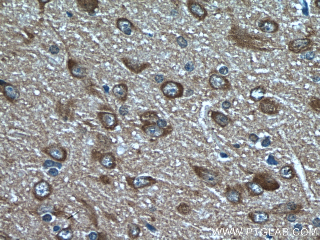 VGLUT1 Antibody IHC rat brain tissue 55491-1-AP