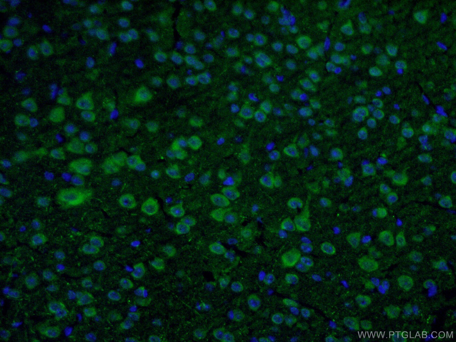 IF staining of mouse brain tissue using 22524-1-AP