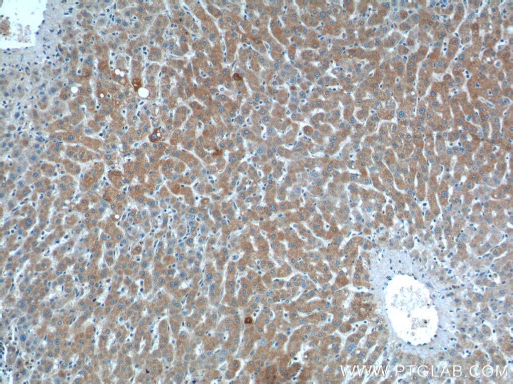 IHC staining of paraffin-embedded human liver tissue using Smad7 (25840-1-AP)antibody at a dilution of 1:200 (10x objective)