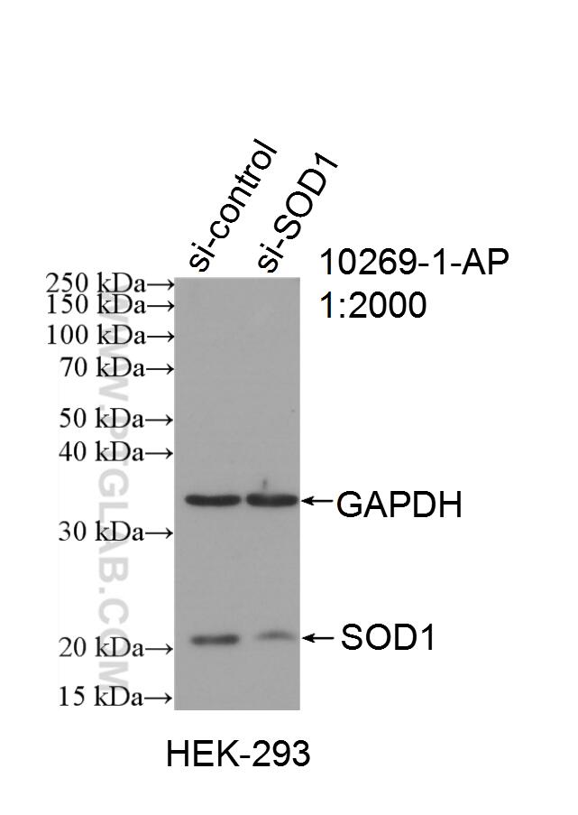 SOD1-Antibody-10269-1-AP-WB-171084.jpg