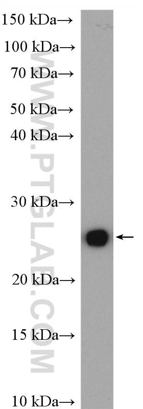 SOD2 Antibody WB HeLa cells 24127-1-AP