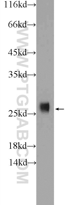 SOD2 Antibody WB MCF-7 cells 24127-1-AP