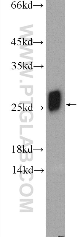 SOD2 Antibody WB DU 145 cells 24127-1-AP