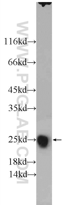 SOD2 Antibody WB mouse brain tissue 24127-1-AP