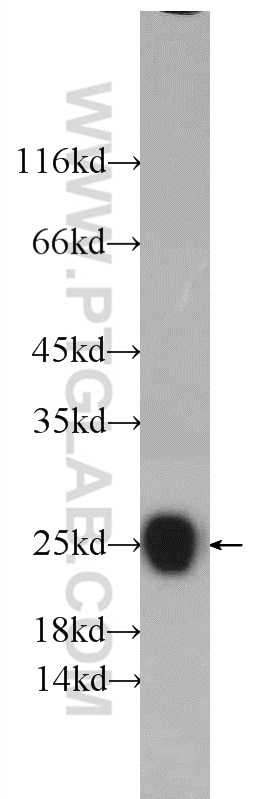 SOD2 Antibody WB rat brain tissue 24127-1-AP
