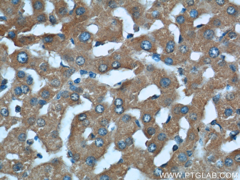 STAT3 Antibody IHC human liver tissue 60199-1-Ig