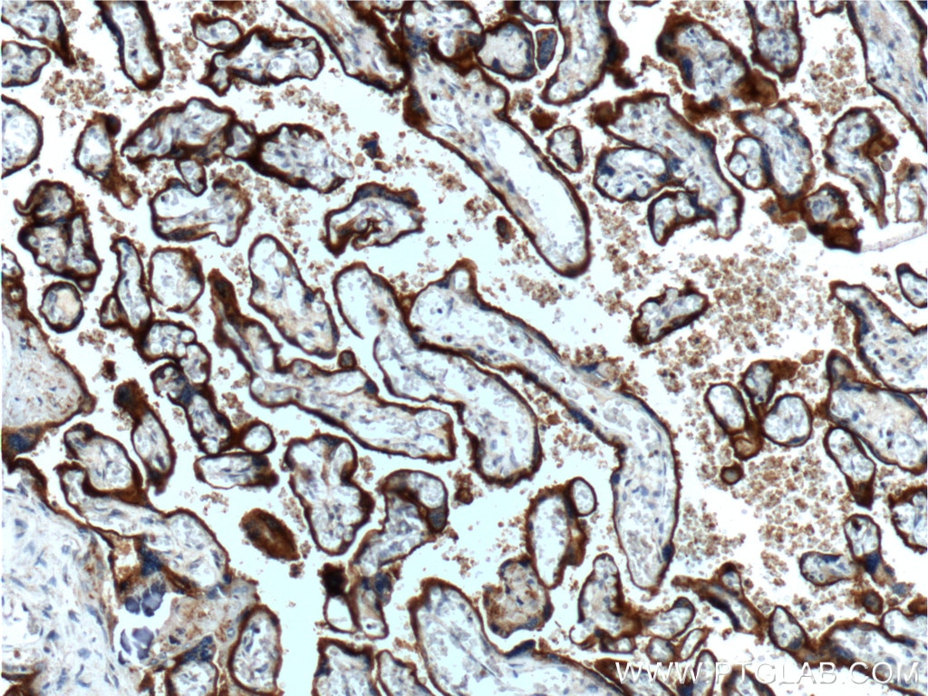 Cd71 Antibody 2 Ap Proteintech Cd71 Antibody 2 Ap Proteintech