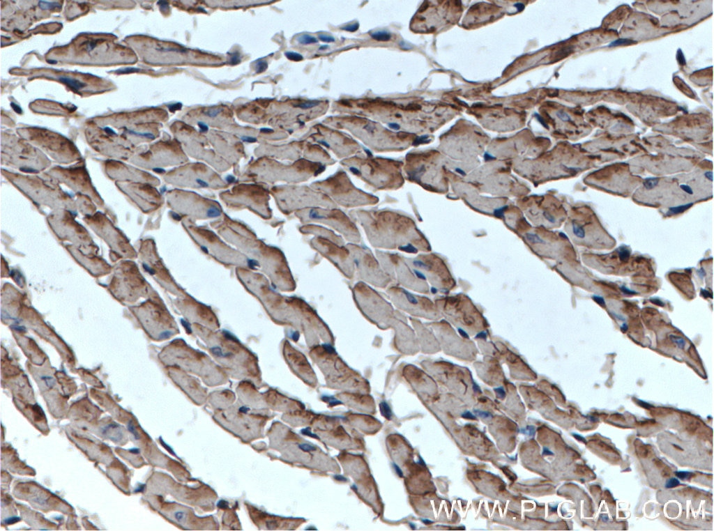 Immunohistochemical analysis of paraffin-embedded mouse heart tissue slide using 15513-1-AP (Cardiac Troponin T antibody) at dilution of 1:200 (under 40x lens) heat mediated antigen retrieved with Tris-EDTA buffer(pH9)