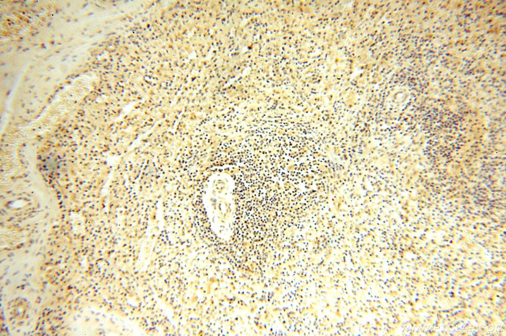 TRBP Antibody IHC human spleen tissue 15753-1-AP