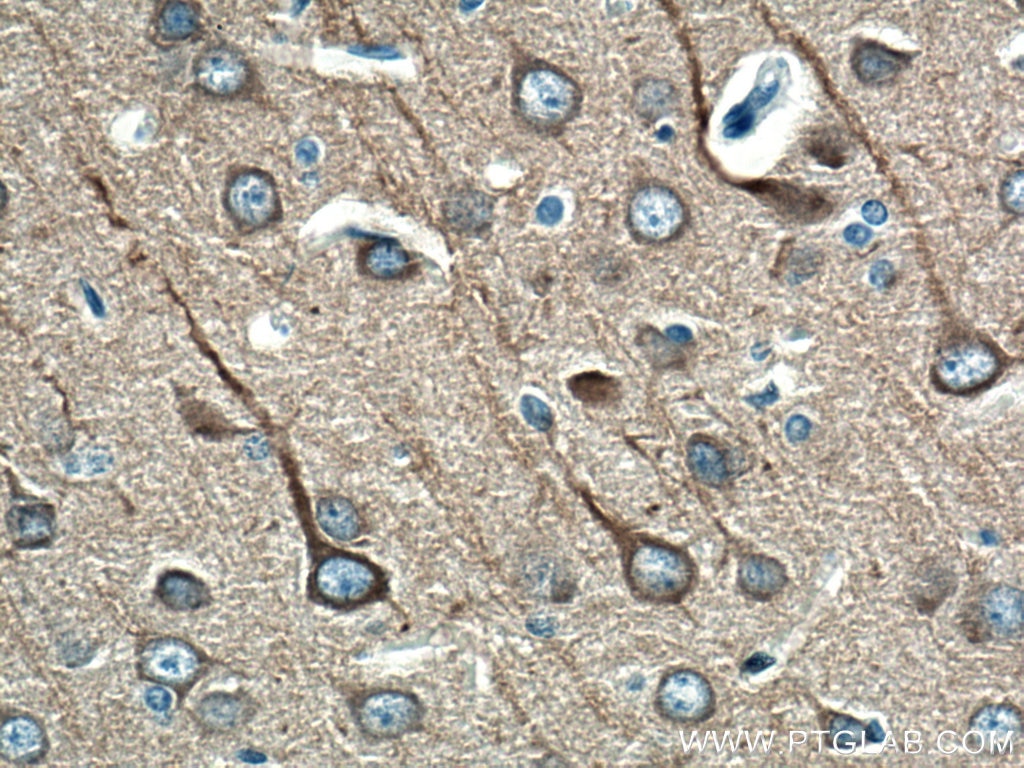 Beta Tubulin Antibody IHC rat brain tissue 10068-1-AP