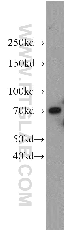 ラット脳組織溶解物をSDS PAGEに付した後、UBQLN2抗体と室温で1.5時間インキュベートしたウエスタンブロットUBQLN2 antibody validated in WB